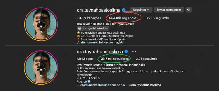 Crescimento de seguidores de conta operada pela Kimera