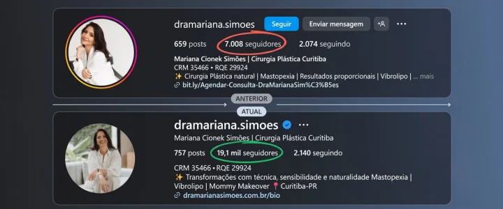 Crescimento de seguidores de conta operada pela Kimera