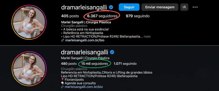 Crescimento de seguidores de conta operada pela Kimera