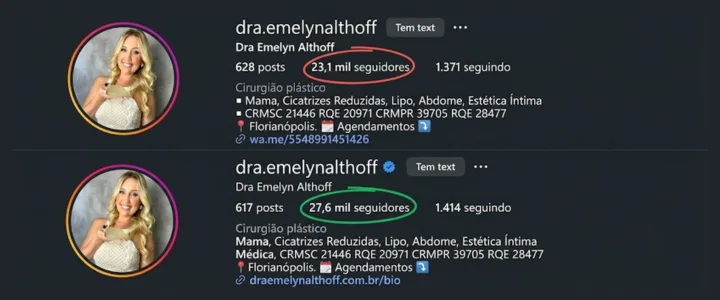 Crescimento de seguidores de conta operada pela Kimera