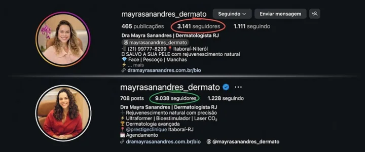 Crescimento de seguidores de conta operada pela Kimera